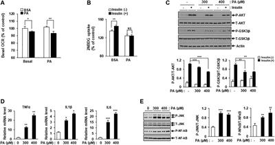 A Class I Histone Deacetylase Inhibitor Attenuates Insulin Resistance and Inflammation in Palmitate-Treated C2C12 Myotubes and Muscle of HF/HFr Diet Mice